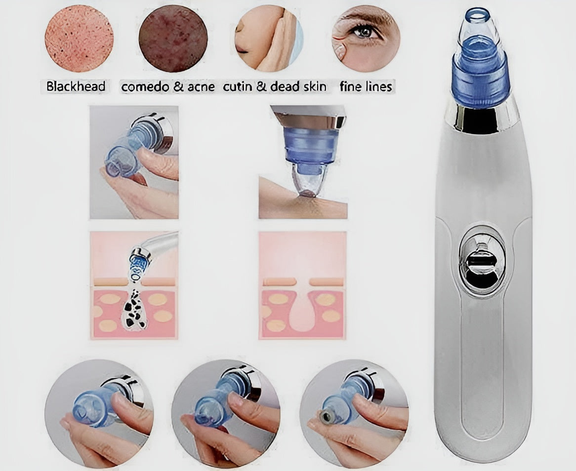 Derma Suction Blackheads Remover 3 In 1